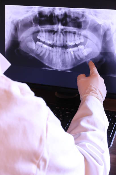 Best Emergency Dentist for Knocked-Out Tooth in Spring Valley Village, TX