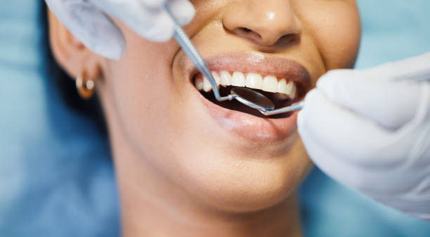 Best Emergency Dentist for Knocked-Out Tooth in Spring Valley Village, TX